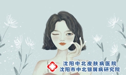 妇女得牛皮癣的发病原因 如何治疗牛皮癣