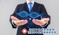 易过敏如何预防沈阳银屑病呢