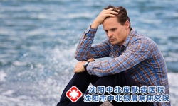 中重度银屑病的治疗方法有哪些?