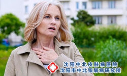 准确介绍牛皮癣的各种病因
