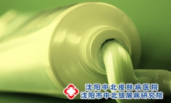 点滴状银屑病的外用药?
