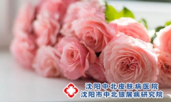 牛皮癣患者生活中注意什么
