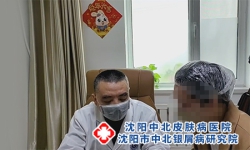 沈阳中北牛皮癣医院：如何判断自己是不是牛皮癣
