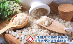 生活四妙招让牛皮癣从此不再牛