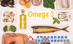 头部牛皮癣的饮食注意 头部牛皮癣怎么护理好