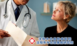 老年牛皮癣特点