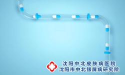 怎样做好牛皮癣的预防工作