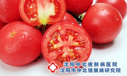 牛皮癣患者的健康食谱有什么呢