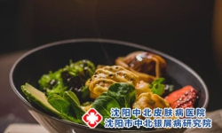 牛皮癣合理饮食注意事项