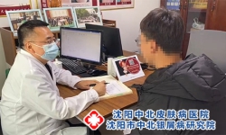 银屑病治疗最好的医院 银屑病就诊实用指引指南
