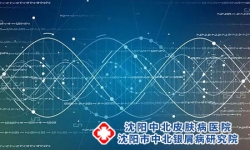 牛皮癣疾病的复发率高不高？