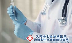 银屑病要怎么对症才能治疗呢?