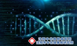银屑病可以基因治疗吗?