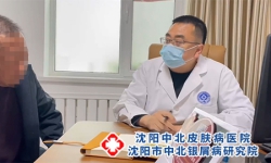 沈阳银屑病十佳医院！牛皮癣与其他皮肤病应该如何区分