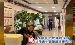 网传三七粉能治银屑病?这些真相别被漏掉