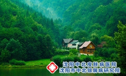 潮湿跟牛皮癣有关系吗？