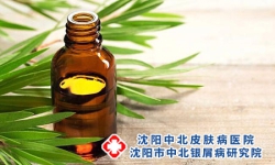 牛皮癣为什么春季犯了?