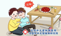 牛皮癣患者的饮食 牛皮癣能吃小龙虾吗