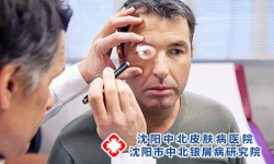 泛发性脓疱型银屑病的并发症有哪些?