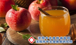 牛皮癣可以吃酸的食品吗？