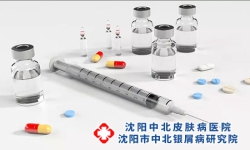 沈阳治疗银屑病专科医院；全身牛皮癣的治疗方法有哪些