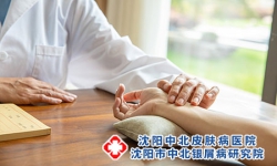 沈阳银屑病最新消息：了解银屑病的病因、症状与治疗方法