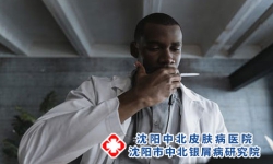 四个原因让你得上了牛皮癣-牛皮癣的危害有哪些呢？