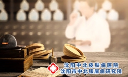 生活中预防沈阳牛皮癣该怎么做
