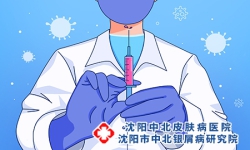 沈阳牛皮癣专家讲早期牛皮癣治疗