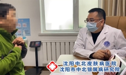 沈阳中北牛皮癣可以报销吗沈阳牛皮癣医院哪个医生看的好