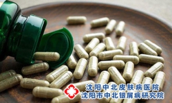 牛皮癣冬季保健注意要点有什么呢