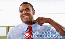 牛皮癣疾病症状的主要表现