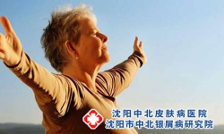 红皮型牛皮癣患者夏天需要注意什么事项