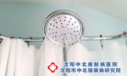 牛皮癣患者该如何正确洗澡。