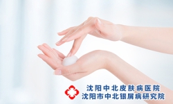 适合银屑病患者使用的润肤品