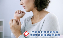 银屑病最易出现的同形反应时机揭秘，沈阳银屑病医院，沈阳牛皮癣医院，沈阳皮肤病医院