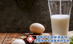 银屑病患者能喝牛奶吗?