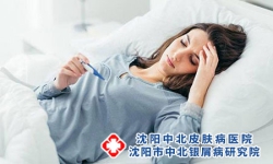 牛皮癣为什么气血不通畅？
