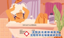 如何正确清洗银屑病皮损？