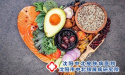 牛皮癣缺什么维生素？