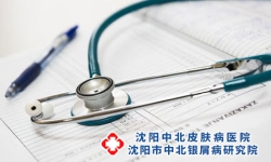 如何降低银屑病复发率？