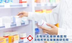 沈阳牛皮癣吃阿司匹林可以吗