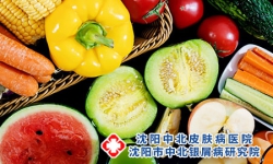 点滴状银屑病饮食禁忌有哪些吗?