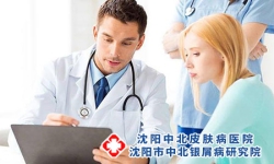点状牛皮癣的鳞屑有哪些独特的特点?