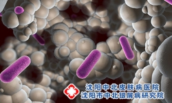 诱发牛皮癣的因素有哪些？