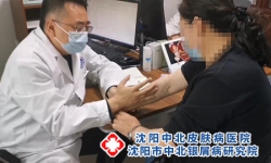 银屑病和什么病相似？银屑病与相似皮肤病的鉴别指南：科学诊断是治疗前提