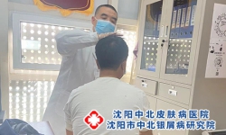沈阳正规牛皮癣医院：牛皮癣如何注意饮食