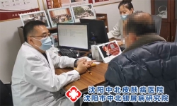 沈阳看皮肤病厉害的医生-长湿疹用什么可以消除