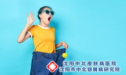 沈阳儿童牛皮癣应如何护理