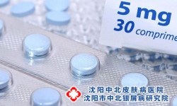 吃消炎药能否治疗牛皮癣呢?